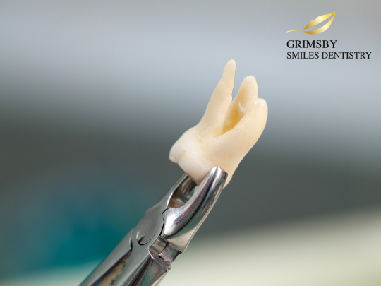 Wisdom teeth removal recovery consultation at Grimsby Smiles Dentistry